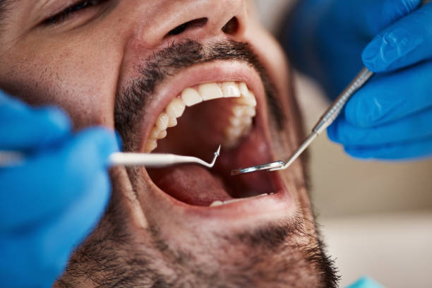 Best Full Mouth Reconstruction  in Mariemont, OH